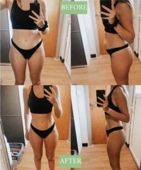 Bikinibody before and after result - Teatox